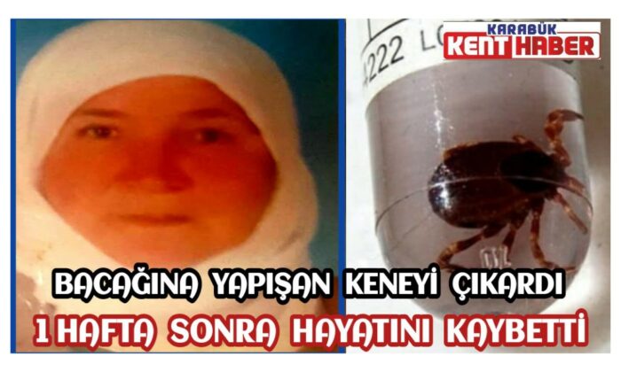 Bacağına yapışan keneyi çıkardı, 1 hafta sonra hayatını kaybetti