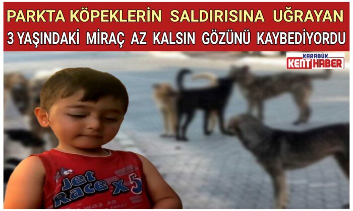Köpeklerin saldırısına uğrayan 3 yaşındaki MİRAÇ az kalsın gözünden oluyordu