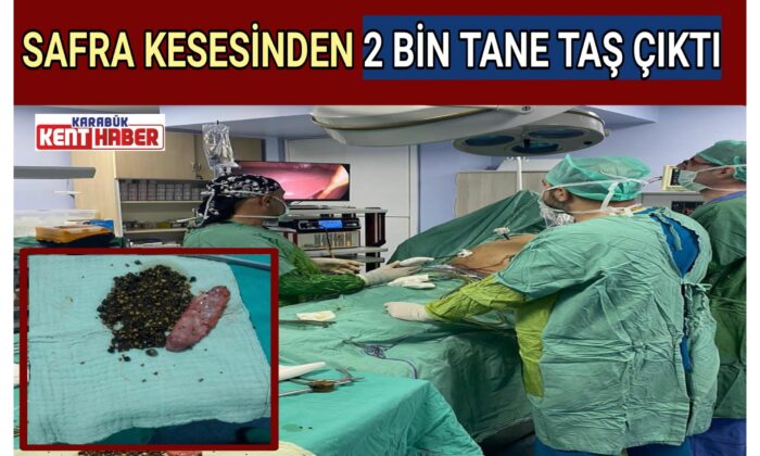 SAFRA KESESİNDEN 2 BİN TANE TAŞ ÇIKTI